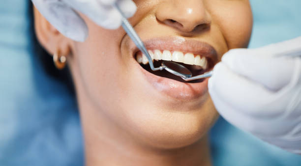 Best Emergency Root Canal Treatment in Vass, NC